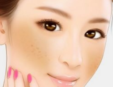 激光祛黃褐斑要做多少次