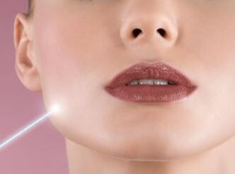 做激光祛斑對皮膚有副作用嗎