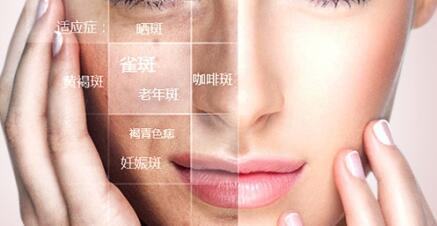 激光祛斑恢復(fù)自然需要多長(zhǎng)時(shí)間