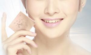 做 激光祛斑要多少錢