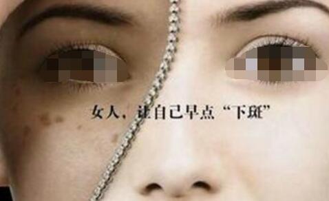 皮秒祛斑恢復(fù)時間長嗎