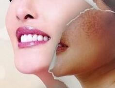 怎樣祛斑速度比較快