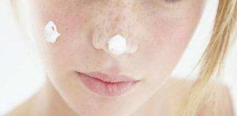 激光祛斑效果反彈還能再做嗎