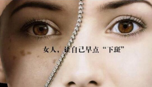 激光祛斑會(huì)有后遺癥嗎