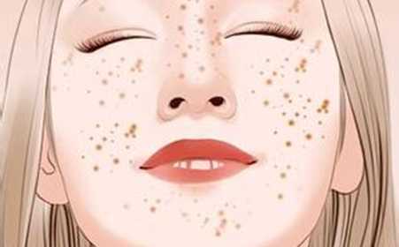 做完激光祛雀斑之后能洗臉嗎