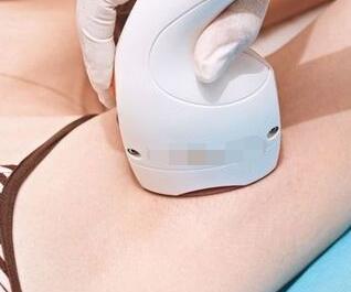 激光脫毛后還會(huì)再長(zhǎng)嗎