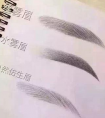 紋眉的過程是怎么樣的