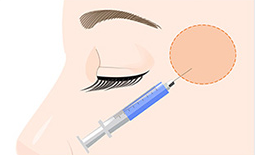 玻尿酸豐太陽(yáng)穴安全嗎