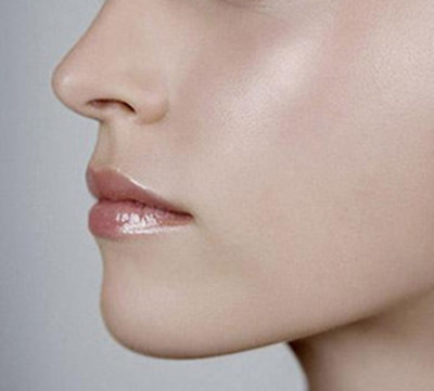 玻尿酸隆鼻打多少次才比較好