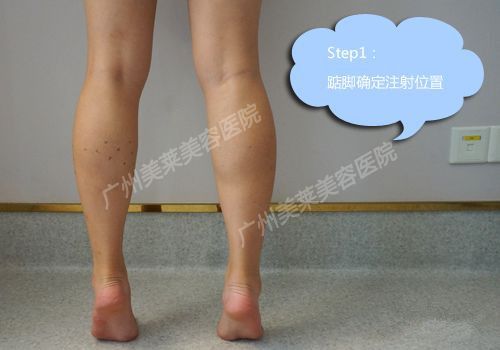 瘦腿針要隔多久才能打第二次呢