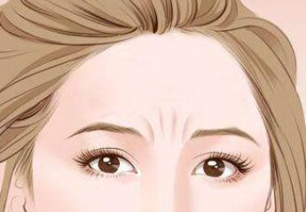 玻尿酸祛眉間紋有效嗎