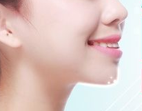 玻尿酸豐下巴多久才能消腫