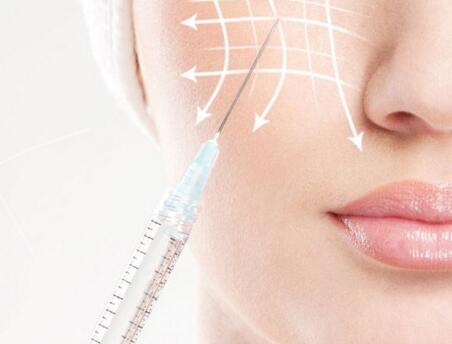 玻尿酸填充要多少錢