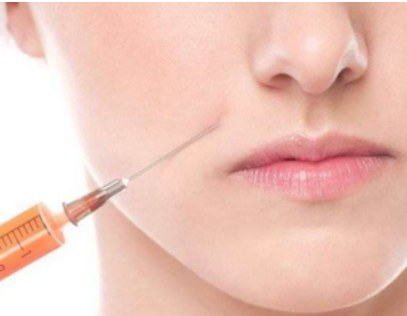 玻尿酸填充會(huì)影響上班嗎