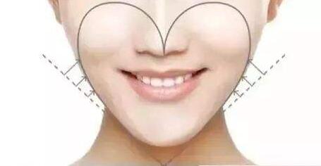 瘦臉針打多了會有什么副作用