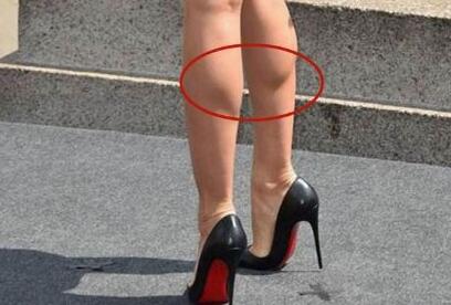 如何縮小小腿的肌肉