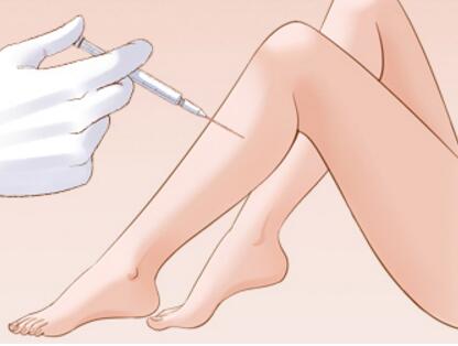 怎樣能瘦小腿比較快