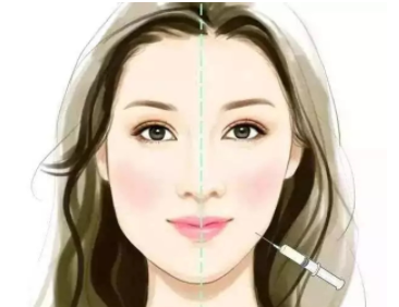 打完瘦臉針后會不會有后遺癥