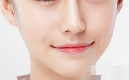 縮小鼻翼有風(fēng)險(xiǎn)嗎