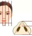鼻翼縮小手術(shù)的后遺癥明顯嗎