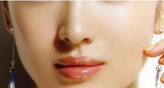 鼻翼縮小手術(shù)多久才能消腫