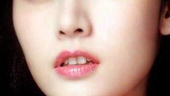 做鼻翼縮小手術(shù)會影響上班嗎