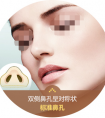 鼻翼縮小手術(shù)恢復(fù)期間要注意的護理事項