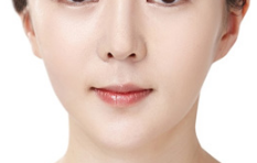 做鼻翼縮小手術會影響鼻子健康嗎