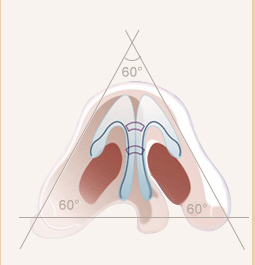 縮鼻翼手術(shù)安全嗎