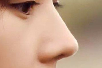  鼻翼縮小手術(shù)會有疤痕嗎
