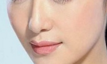 隆鼻用哪一種材料會比較好呢