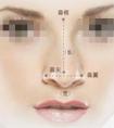 假體隆鼻手術(shù)術(shù)后的保養(yǎng)事項(xiàng)