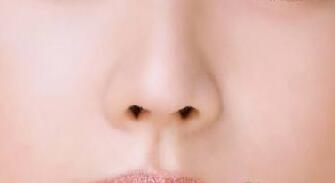 假體隆鼻修復(fù)要注意什么