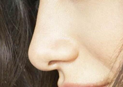 假體隆鼻痛不痛