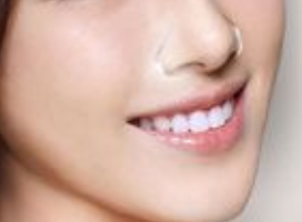 假體隆鼻能保持多久