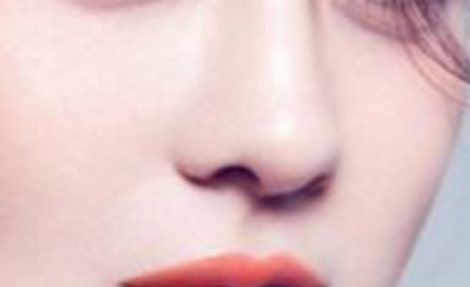 假體隆鼻可以保持多少年