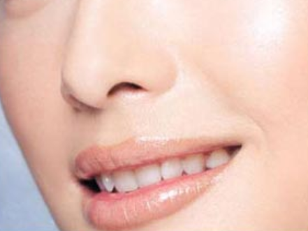 假體隆鼻多久可以上班