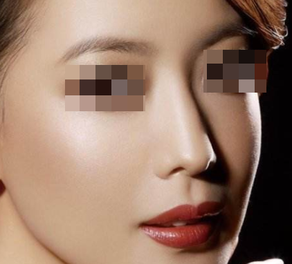 假體隆鼻的價格范圍是多少