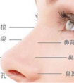 假體隆鼻怎么護(hù)理恢復(fù)更快