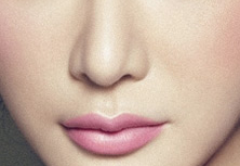 假體隆鼻的材料有哪些