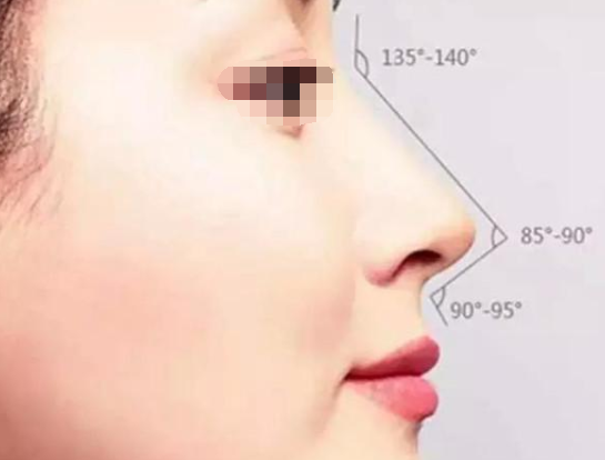 假體隆鼻手術(shù)當(dāng)天可以回家嗎