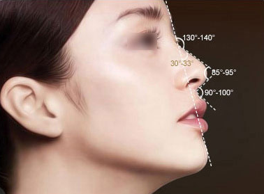 自體軟骨隆鼻能夠保持多久