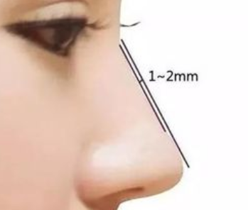 自體軟骨隆鼻多久才穩(wěn)定下來