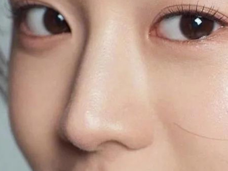 耳軟骨隆鼻會不會被吸收