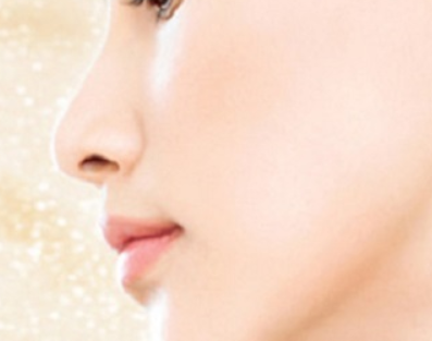 肋軟骨隆鼻術后會被吸收嗎