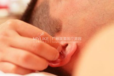 高建華醫(yī)生真實(shí)案例：耳朵再造