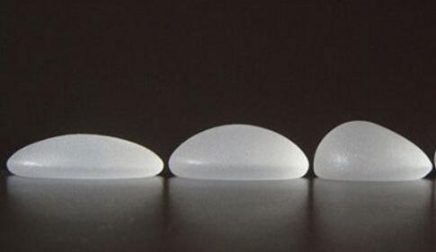 假體隆胸術(shù)后的痛感明顯嗎