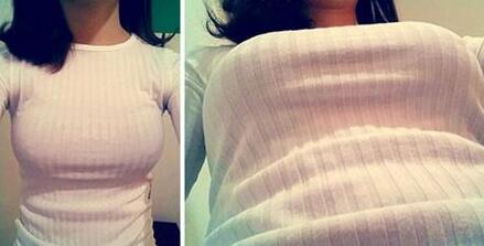 假體隆胸選擇多大型號比較好