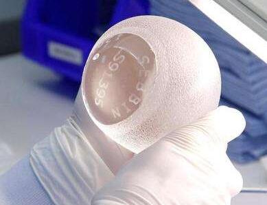 假體豐胸恢復期長嗎