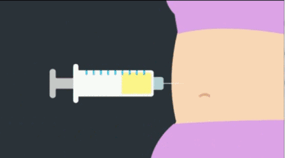 自體脂肪豐胸比假體豐胸有哪些優(yōu)勢(shì)好處